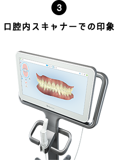 03.口腔内スキャナーでの印象